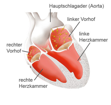 Presseinformation zum Thema "Defekter „Stoßdämpfer“ in Herzmuskelzellen trägt zur Entstehung von Vorhofflimmern bei"