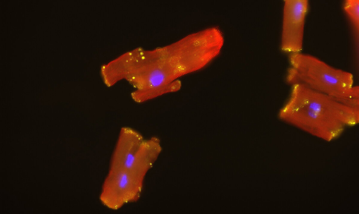 Mechanische Herzunterstützung fördert Regeneration von Herzmuskelzellen